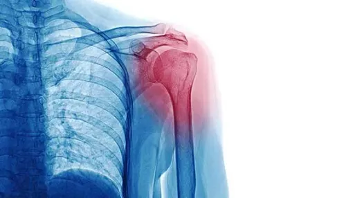 Shoulder Joint Problem treatment service image